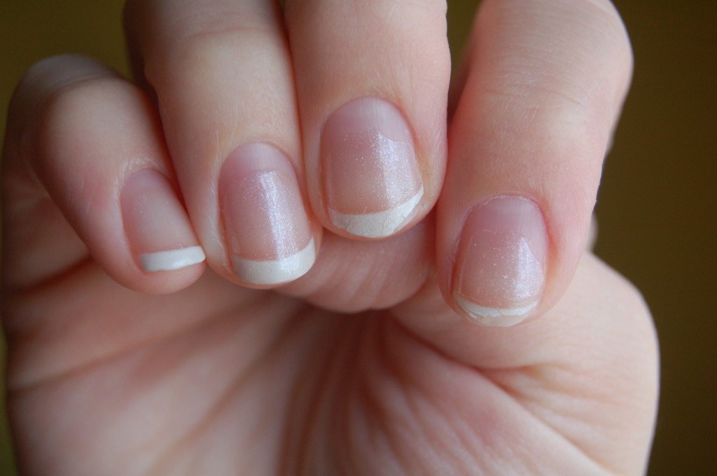 Acrylic Nail Damage